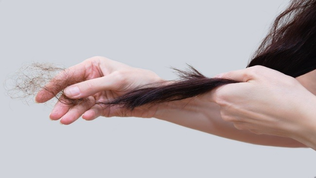 Cara Efektif Mengatasi Rambut Rontok